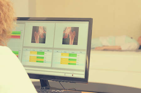 A woman x-ray examines the results of densitometryの写真素材