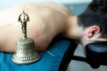 Handsome young man in an acupuncture and sound therapyの写真素材