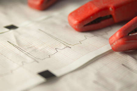 Close up of an electrocardiogram in paper form.の写真素材