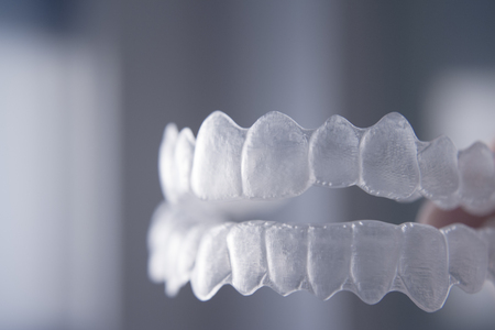 Orthodontic temporary removable straighteners in dental office dentists surgeryの写真素材