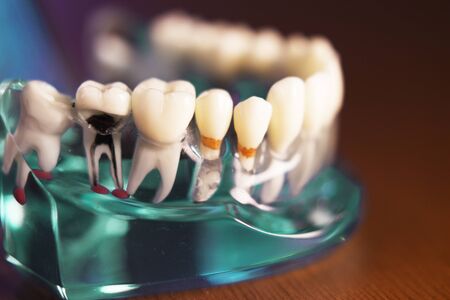 Denture for dentistry students with different health problems