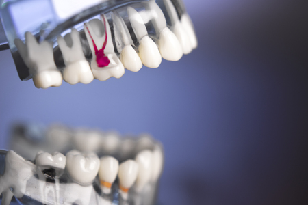 Denture for dentistry students with different health problems