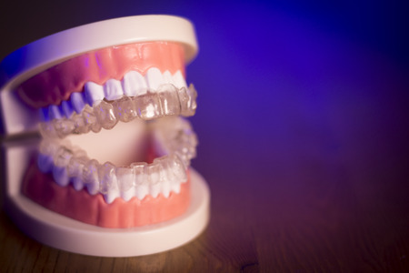Denture for dentistry students with transparent orthodonticsの写真素材
