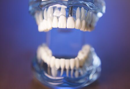 Denture for dentistry students with different health problemsの写真素材