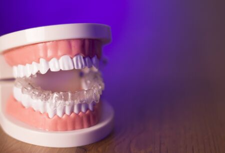 Denture for dentistry students with transparent orthodonticsの写真素材