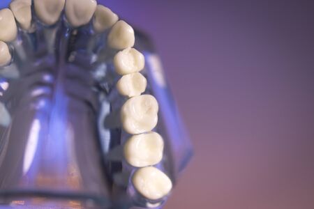 Denture for dentistry students with different health problemsの写真素材