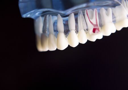 Denture for dentistry students with different health problemsの写真素材
