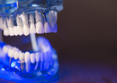 Denture for dentistry students with different health problems