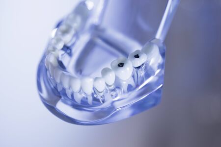 Denture for students on colored backgroundの写真素材