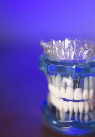 Transparent dental orthodontics for adults and childrenの写真素材