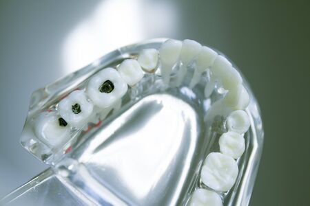 False teeth sample for dentistsの写真素材