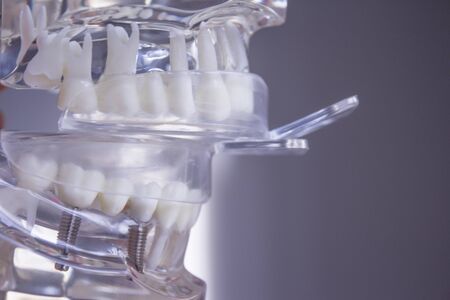 Silicone molds to make dentures inside a false mouthの写真素材