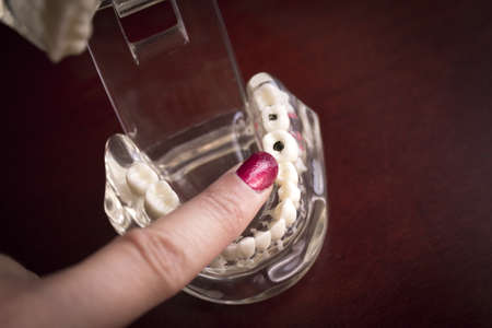 Denture pointed by fingers of woman