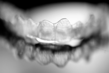 Dental aligner. Invisible dental orthodonticsの写真素材