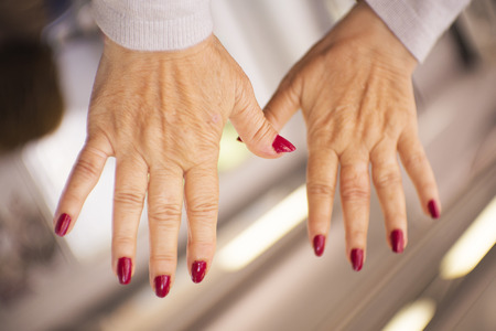 Hands of a middle aged woman with problems of rheumatism, osteoarthritis and skin blemishesの写真素材