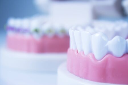 Model denture with metal orthodontics. No peopleの写真素材