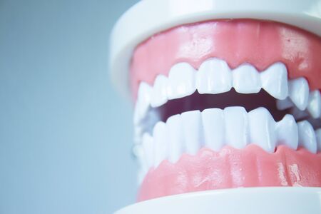 Model denture with metal orthodontics. No peopleの写真素材