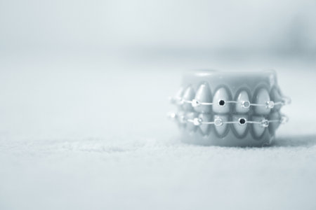 Metal orthodontic denture base. No peopleの写真素材