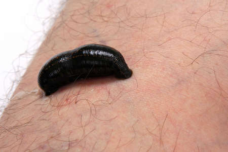Blood sucking leech on a man's leg. Isolated on white background. Alternative medicine.の写真素材