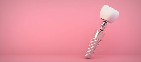 Dental prothesis on pink