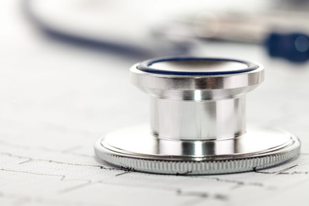 Closeup of stethoscope lying on ecg diagram