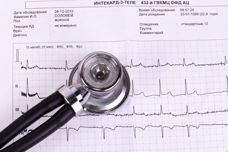 Closeup of stethoscope on ecg diagram background