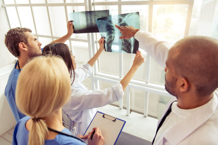 Medical doctors of different nationalities and genders are examining and discussing X-raysの写真素材