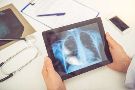 Cropped image of handsome medical doctor examining radiograph on tablet while working in his officeの写真素材