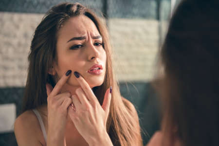 Beautiful girl in white bra is squeezing pimples on her face while looking into the mirror in bathroomの写真素材