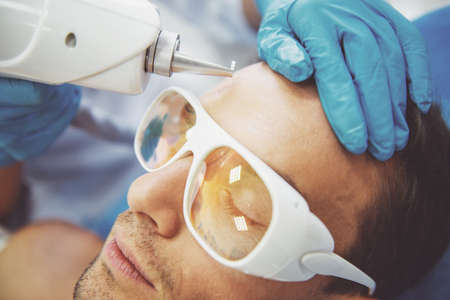 Handsome man is getting face skin treatment. Doctor is undertaking the procedure using a modern equipment, close-upの写真素材