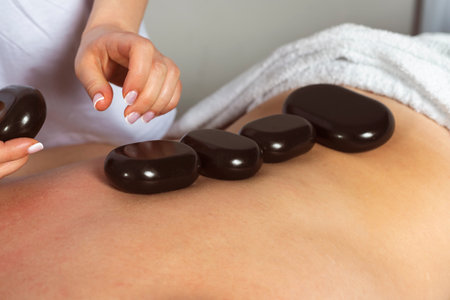 A professional masseuse or massage therapist is placing hot stones on a client's back, the client lies partially covered with a towel on the massage table. Hot stone massage.の写真素材