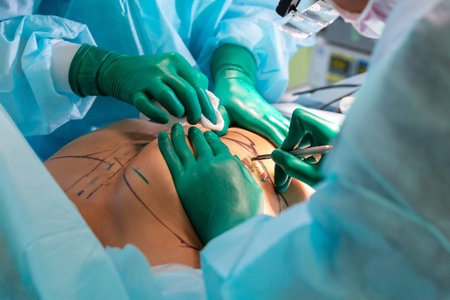 Surgeons team working with patient. breast augmentation