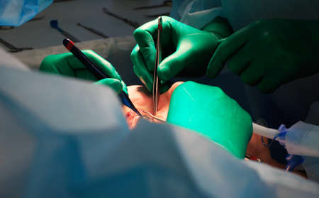 Plastic surgery in operating roomの写真素材