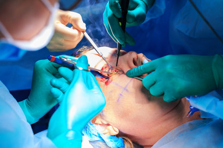 Plastic surgery in operating room