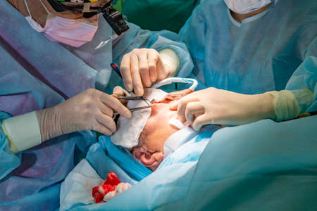 Plastic surgery in operating roomの写真素材