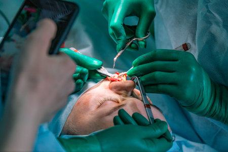 Surgeon and his assistant performing cosmetic surgery on nose in hospital operating room. Nose...