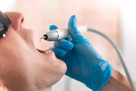 A female dentist examines the oral cavity of the patient with a tool with a mirror. Close-up portrait of a patient with a mouth open, a doctor in gloves holds a dental mirror.の写真素材