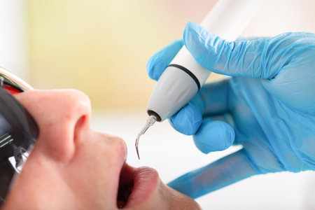Young man visiting the dental office. Dentist hands in protective gloves using ultrasound to clean patients teeth. Closeup of open mouth.の写真素材