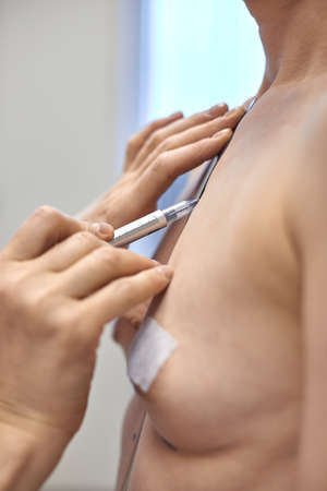 Mid age woman with correction mark for plastic surgeryの写真素材