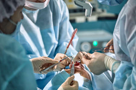 A surgeon with gloves is operating on his nose. Rhinoplasty, close-up operation. Blue light, teamwork, health, beauty.の写真素材