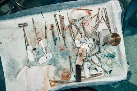 surgical instruments and instruments, including scalpels, forceps and tweezers, located on the table for the operation, during the operation.の写真素材