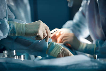 close up surgeons hand taking scissors, forceps and surgical instruments on table for operation with colleagues performing work in operation room at hospital, emergency case, surgery, medical conceptの写真素材