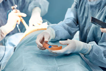 Damaged female breast implant in the hands of a surgeon, surgery to replace breast implants, reconstructive mammoplastyの写真素材