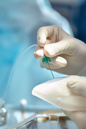 A surgeon with an assistant operates on the female breast, mammoplasty, breast oncology.の写真素材