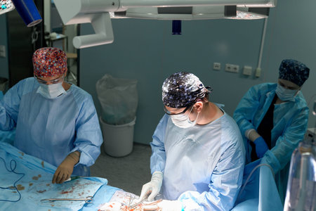 Top view group of surgeons doing surgery in the operating room of the hospital, modern medicine with...