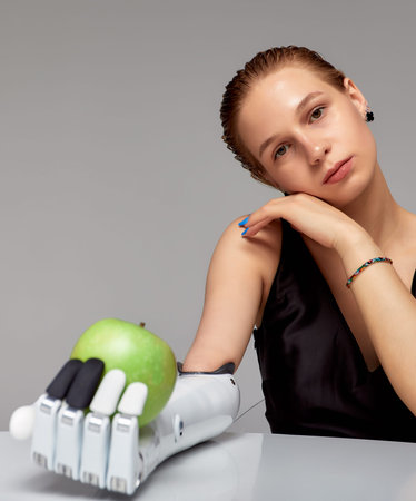 Young girl with disability wearing sensory bionic prosthetic arm seats at the table in studio....