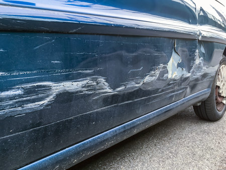 Scratching the side of the blue car. Accident. Misfortune.の写真素材