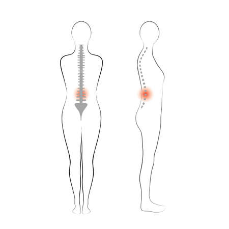 Vector woman body shape,  Vertebrae pain のイラスト素材