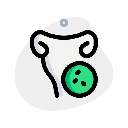 Uterus infected with bacteria isolated on a white backgroundのイラスト素材