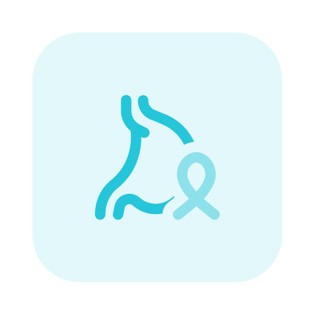 colon cancer related to stomach ulcer and other diseasesのイラスト素材